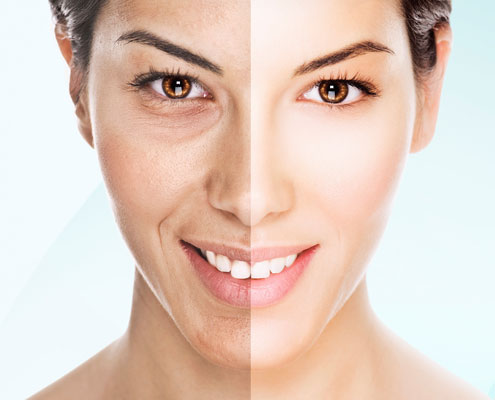 geneo™ - zabieg bankietowy - przełomowa technologia pielęgnacyjno odmładzająca dla uzyskania promiennego wyglądu skóry.
